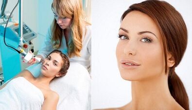 جوهر إجراء تجديد الجلد بالليزر.